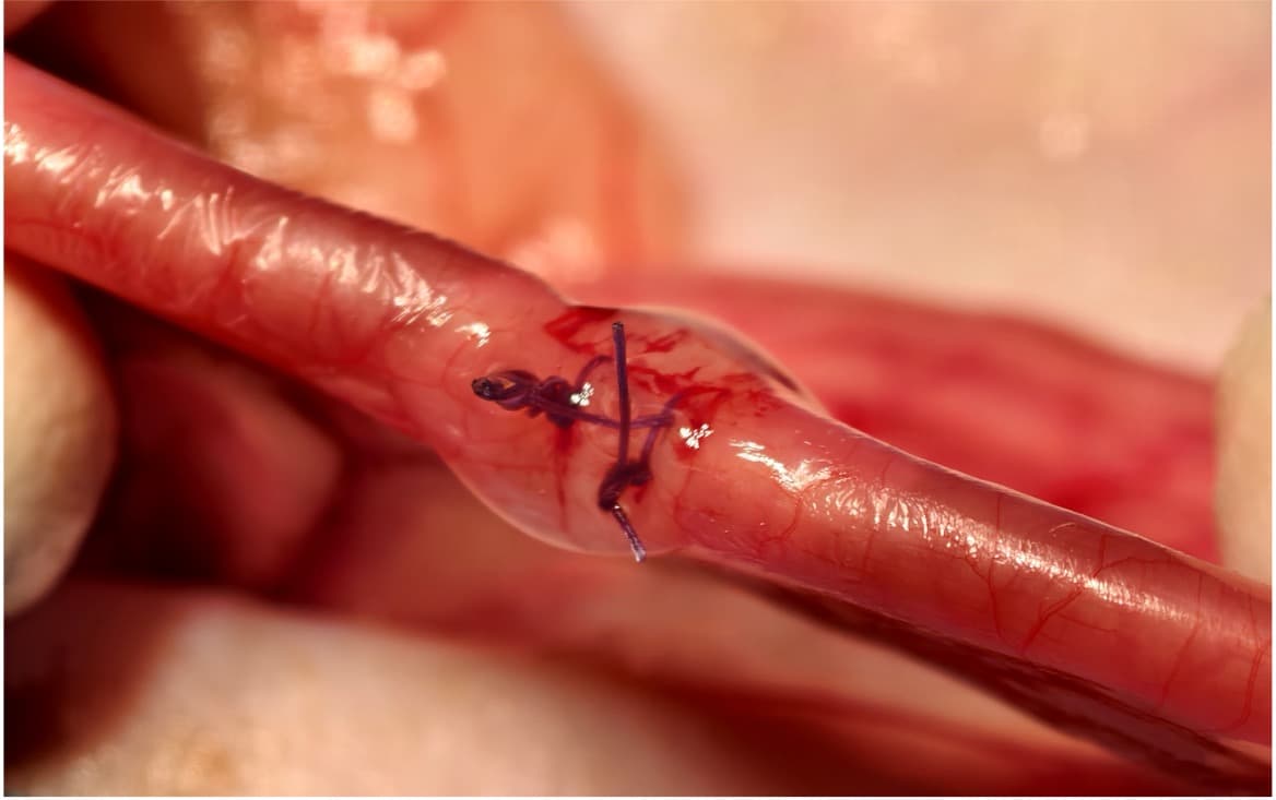 Clinical gastric suturing photograph